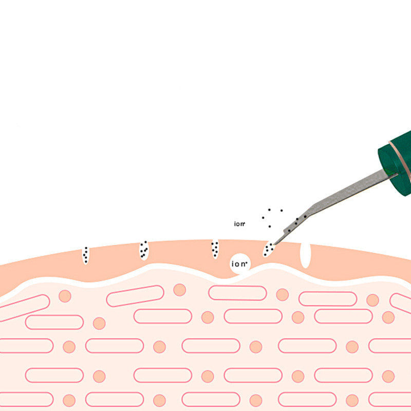 Espátula Ultrasónica Facial – Limpieza Profunda, Rejuvenecimiento y Blanqueamiento en Casa